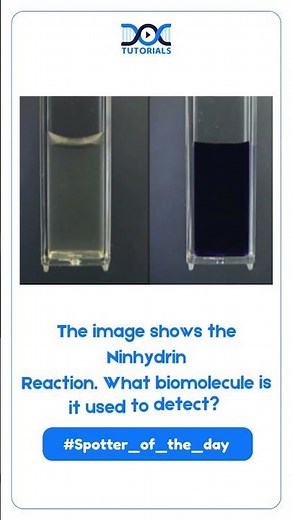 Spotter of the Day | Identify the Biochemical Test & Its Positive Result | MBBS Biochemistry