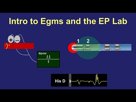 Intro to Intra-cardiac Electrograms & the EP Lab