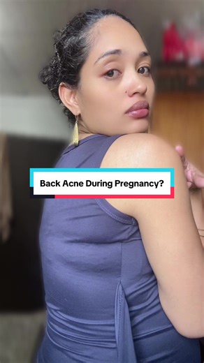 Managing Back Acne During Pregnancy at 35 Weeks