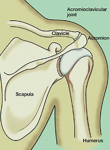 Acromioclavicular (AC) Joint Separation Repair - The Institute for Athletic Medicine