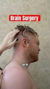 My Life After Brain Surgery 🧠🙏