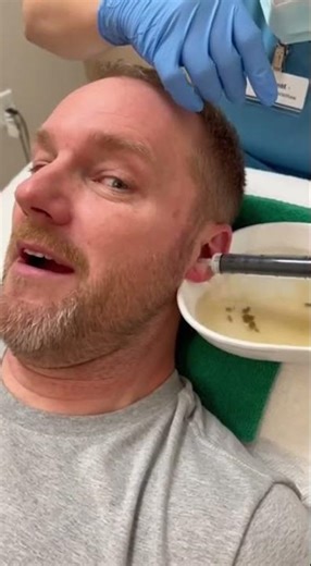 The Most Satisfying Ear Wax Removal Videos