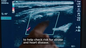 4.2M views · 18 reactions | Screening is Simple. Get Peace of Mind or Early Detection. | Life Line Screening | Facebook