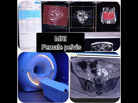 MRI Female pelvis planning and positioning