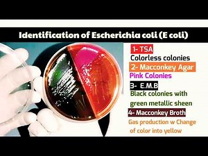 Escherichia coli (E coli) Identification on (EMB, TSA, Macconkey broth & MacConkey Agar)