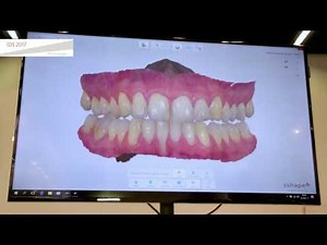 Introducing 3Shape TRIOS Patient Specific Motion