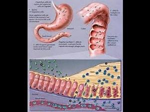 Clostridium Difficile