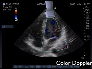 Cardiac Ultrasound