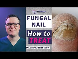 How to Get Rid of Nail Fungus: Home Care & Medical Treatments