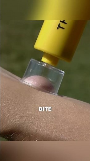 Effective Methods for Removing Snake Venom