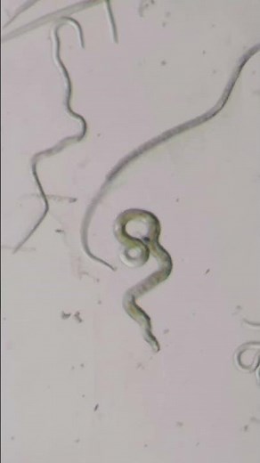 What Are Nematodes?