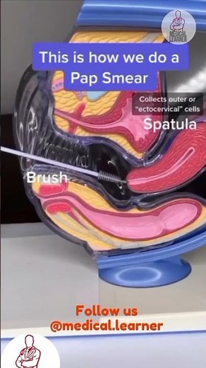 How to do pap smear | pap smear procedure | gynecology pap smear | medical learner | steps to do pap