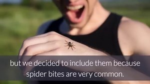 What do Bed Bug Bites look like? Pictures & Identification Steps | Pestbugs