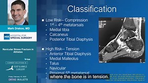9.8K views | New expert video by Mark Drakos. MD - Orthopedic Surgeon...