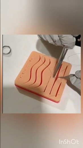 “Subcuticular Suturing: The Art of Scar-less Skin Closure ✨🧵”