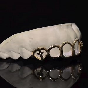 💎 Own the game with our custom-fit grillz. 💸 Buy Now, Pay Later with monthly payments | Custom Gold Grillz