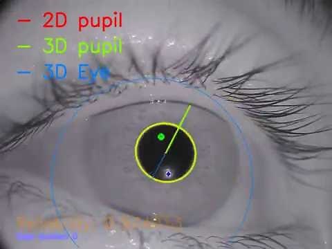 Fast, Accurate, Open-source Eye Tracking