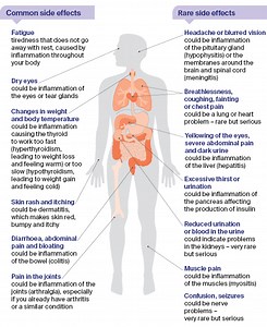 Immunotherapy