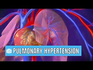 Pulmonary hypertension Animated 3D