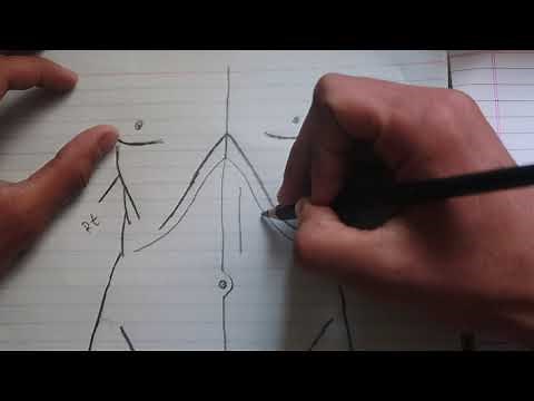 Abdominal surgical incisions : Types