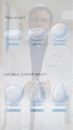 Breast Implant Surgery Explained by Dr. Sabyasachi Basu