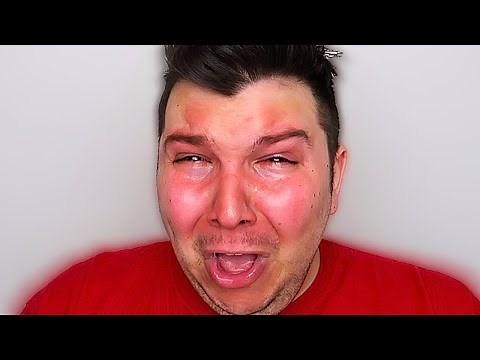 Nikocado Avocado GETS SKINNIER