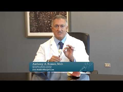 Proximal Biceps Tendon (Biceps Tenodesis Repair)