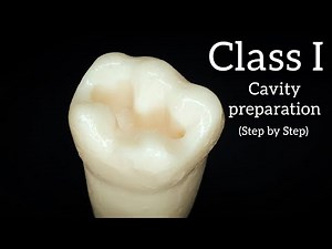 Class I cavity preparation for amalgam restoration step by step mandibular molar خطوة بخطوة مع الشرح