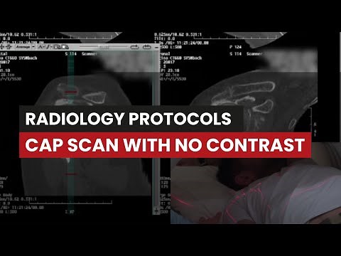 CAP Scan Without Contrast: Protocol Guide for Radiology Techs
