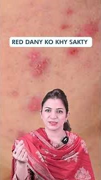 Treatment Of Different Types Of Acne