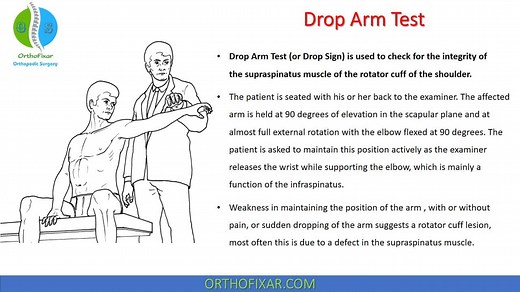 Drop Arm Test For Supraspinatus Tear Explained Easily | OrthoFixar