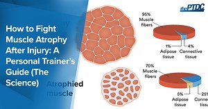How to Fight Muscle Atrophy After Injury: A Personal Trainer’s Guide (The Science)