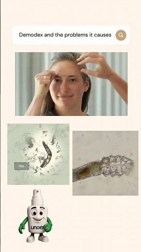 Hidden Cause of Skin Issues? Meet Demodex Mites - #facemites #skincare