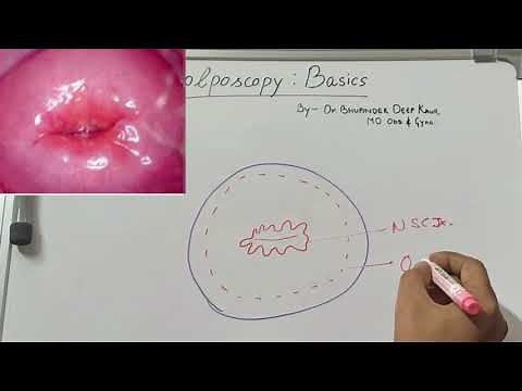 Colposcopy-Basics-Cervix Structure & Histology-Transformation Zone-Normal Cervix@Love_Obs_Gynae