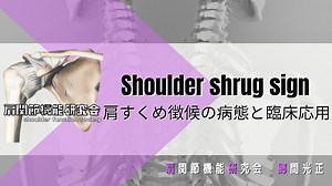 Shoulder shrug signの病態と臨床応用