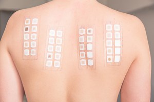 Patch Testing for Allergies | Harley Street Dermatology Clinic