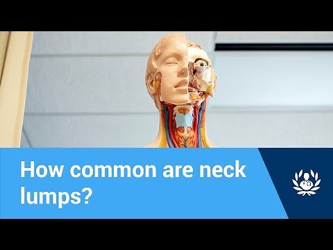 How common are neck lumps?