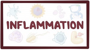 Inflammation: Video, Causes, & Meaning | Osmosis