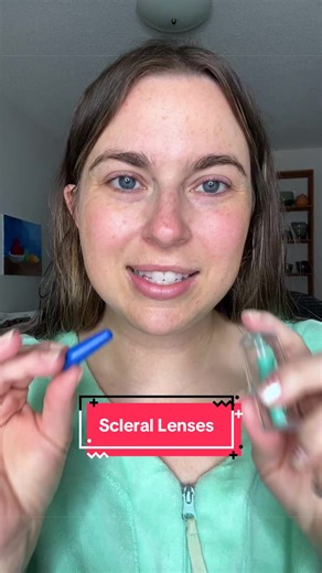 How I insert my my scleral lenses #scleralenses #sclerallenses #contacts #dryeyes #keratoconus
