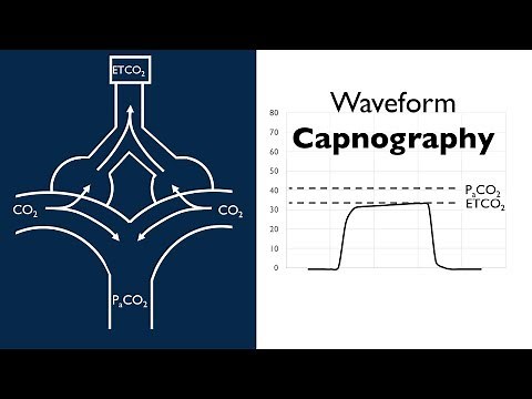 Waveform Capnography -- BAVLS