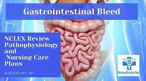 GI Bleed Nursing Diagnosis and Care Plan - NurseStudy.Net