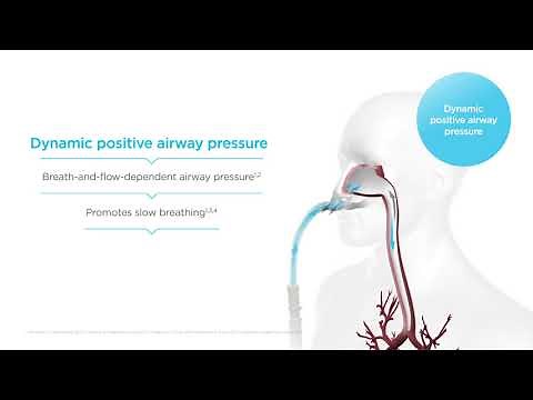 How does Optiflow High Flow work? Mechanisms of action – Dynamic positive airway pressure