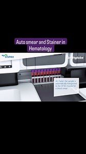 Sysmex Auto Smear and Stainer in Hematology | Medical Lab Technology - MLT Globe