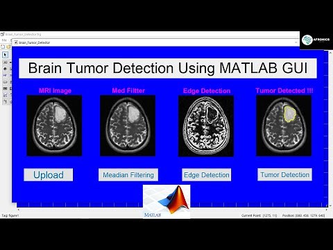 Brain Tumor Detection Using MATLAB GUI with Source Code [Image Processing 2022]