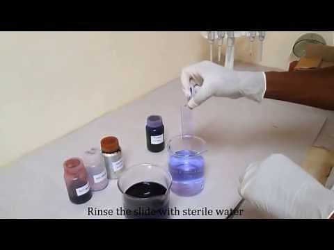 Gram staining for differentiating bacterial species