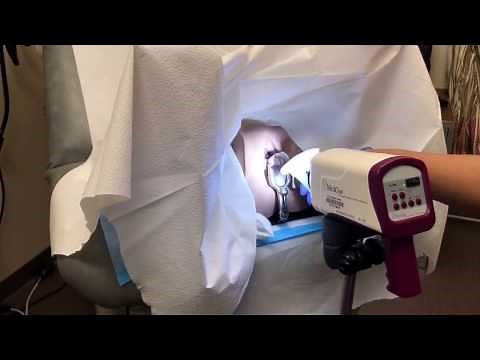 Colposcopy training video - YouTube