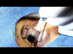 Lucentis for diabetic macular edema improves visual acuity