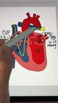 What is a Pulmonary Artery Wedge Pressure