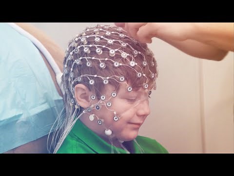 High Density (HD) EEG Testing Services