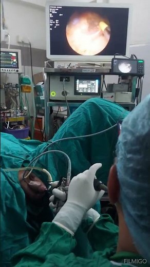 TURP surgery for Prostate